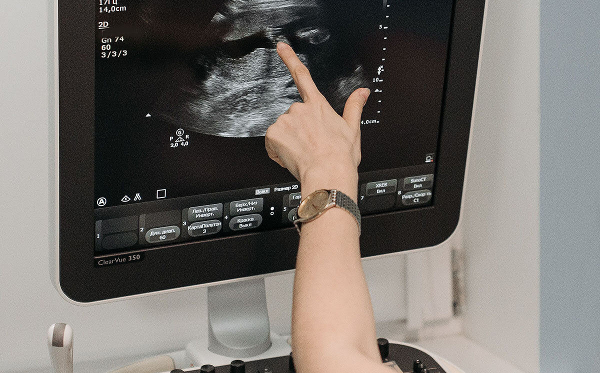 Ginekologa konsultācija un diagnostika Rīgā